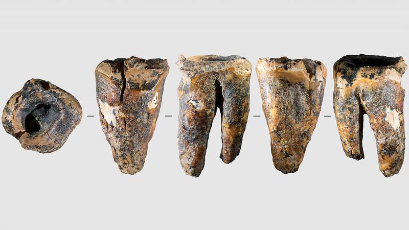 Neandertaler: Erste Zahnbehandlung der Geschichte
