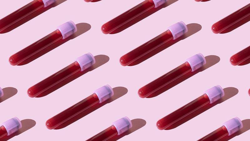 Bluttest zeigt das biologische Alter des Gehirns