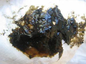 Antibiotika-Resistenzen bei Neugeborenen entdeckt