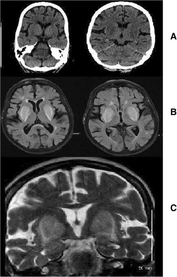 Sozioökonomische Disparitäten und ihre langfristigen neurokognitiven Konsequenzen
