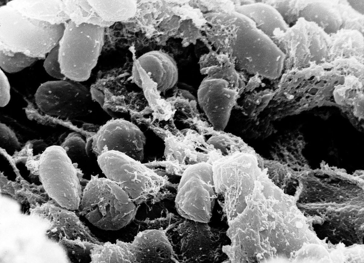 Die ersten Pestausbrüche in Sibirien