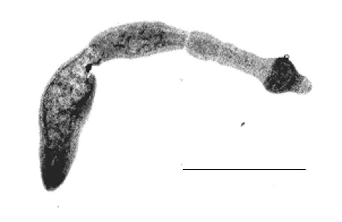 Fuchsbandwurm (*Echinococcus multilocularis*): Eine umfassende Analyse von Übertragungswegen, Risikofaktoren und epidemiologischen Trends