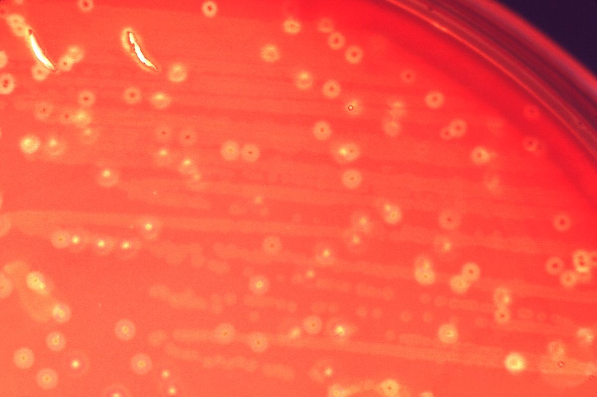 Mundbakterium fördert Magenkrebs: Neue Erkenntnisse