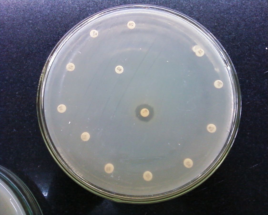 Wie Trockenheit die Verbreitung antibiotikaresistenter Bakterien fördert